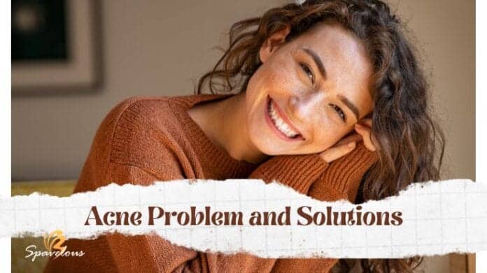 Effective Solutions For Your Acne Problem | Skin Care Product