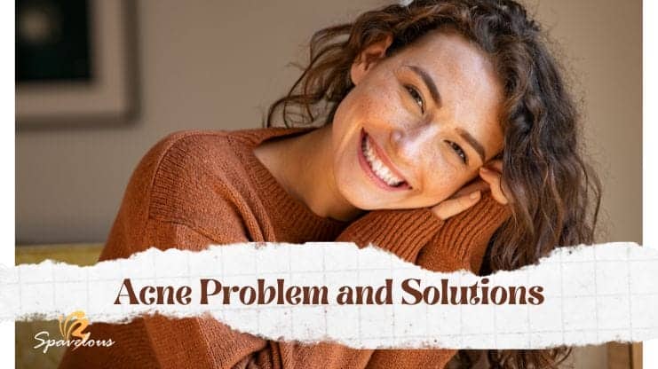 acne problem and solutions