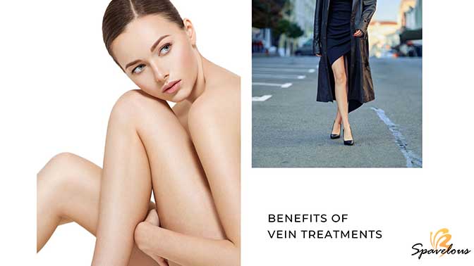 benefits of vein treatments