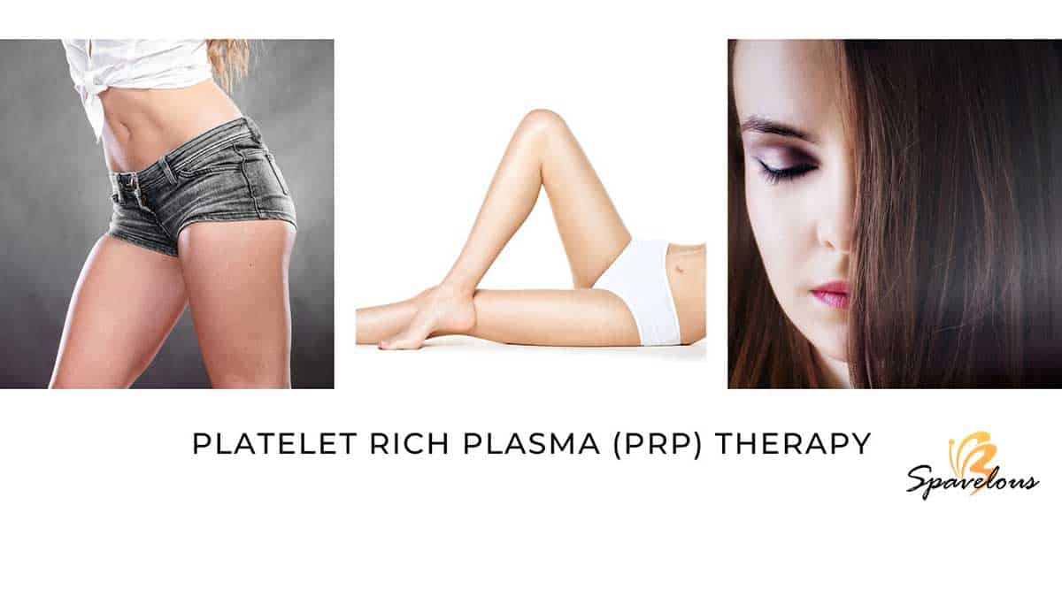 platelet-rich-plasma