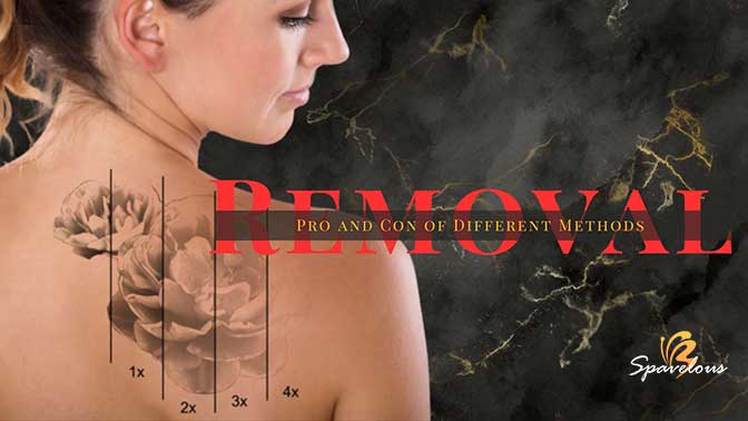 pros and cons of tattoo removal methods