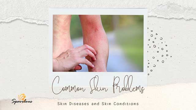 skin allergies and rashes