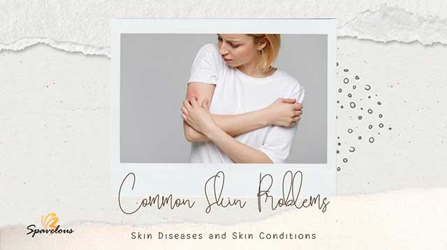 skin conditions and solutions