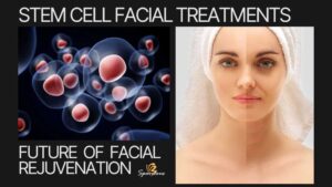 stem cell facial treatments