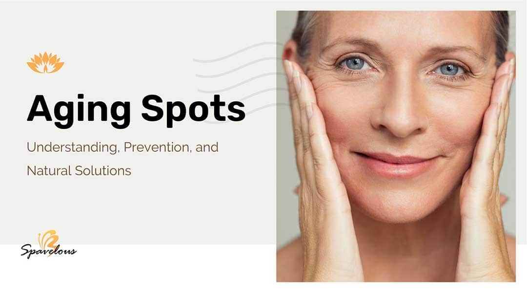 aging spots