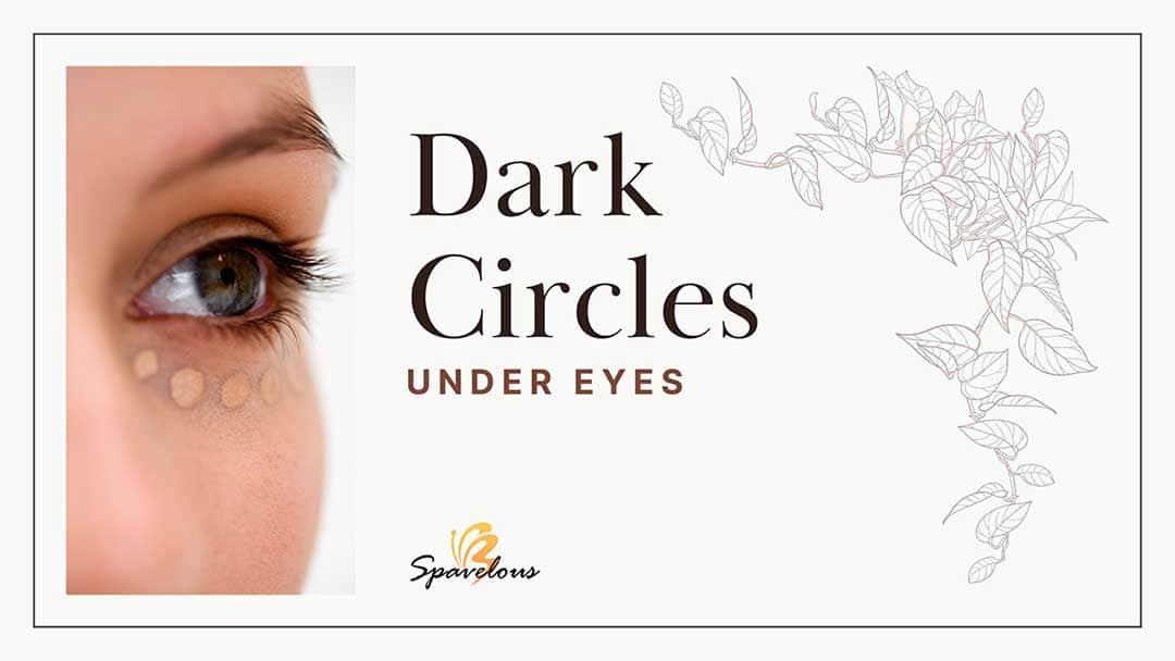 dark circles