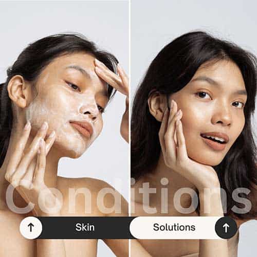 skin conditions and solutions