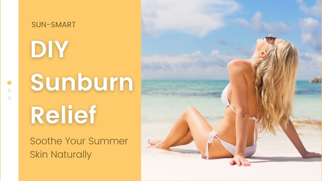 diy sunburn relief